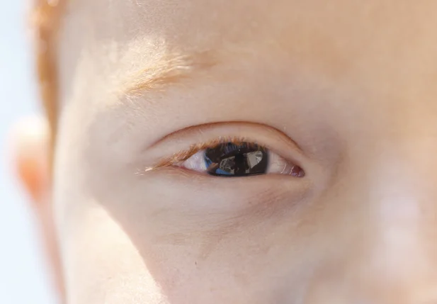 Pessoas com essa condição têm uma pequena área da retina gradualmente danificada