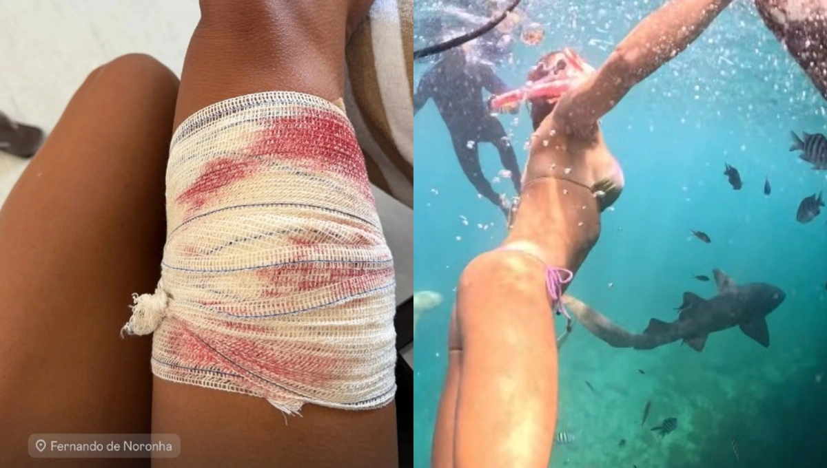 Turista Tayane Dalazen, de 36 anos, foi mordida por um tubarão