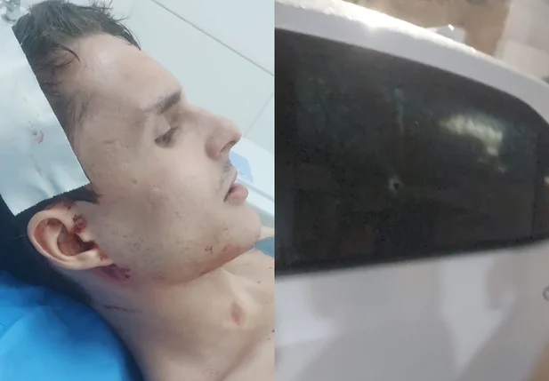 Filho de empresário é baleado