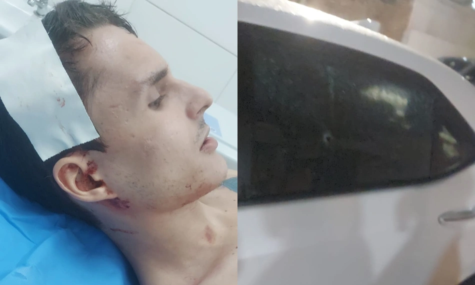 Filho de empresário é baleado