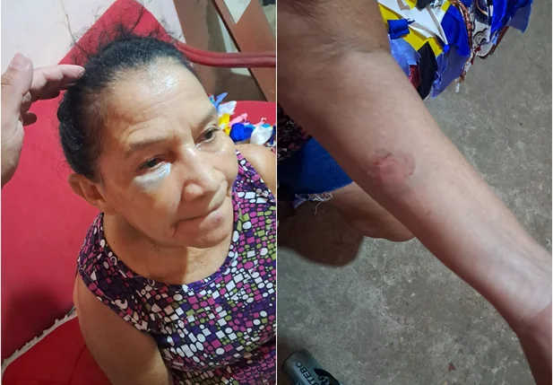 Lindalva Maria Batista morreu no Hospital Municipal de São Gonçalo do Piauí