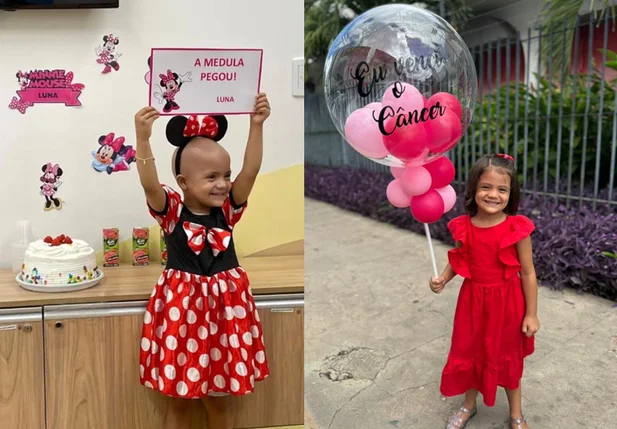 Luna após transplante de medula óssea/ Luna um ano após o transplante