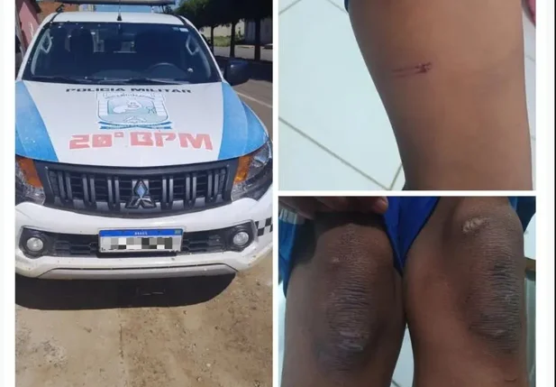 GPM de Betânia do Piauí prendeu padrasto acusado de maus-tratos contra enteado