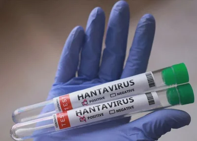 Brasil teve uma morte confirmada por hantavírus em 2026