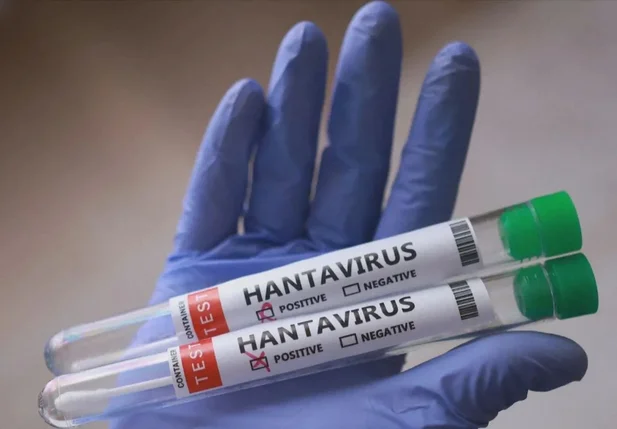 Brasil teve uma morte confirmada por hantavírus em 2026