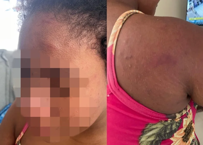 Empregada agredida pela patroa