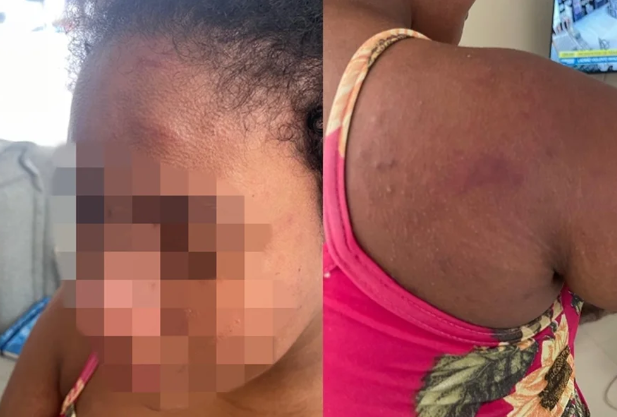 Empregada agredida pela patroa