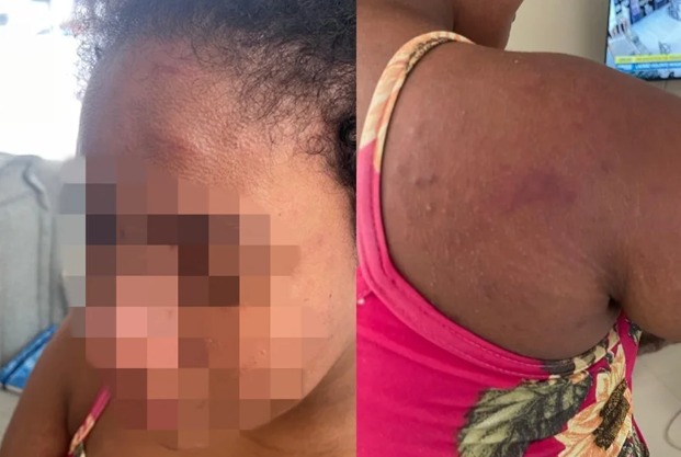 Empregada agredida pela patroa