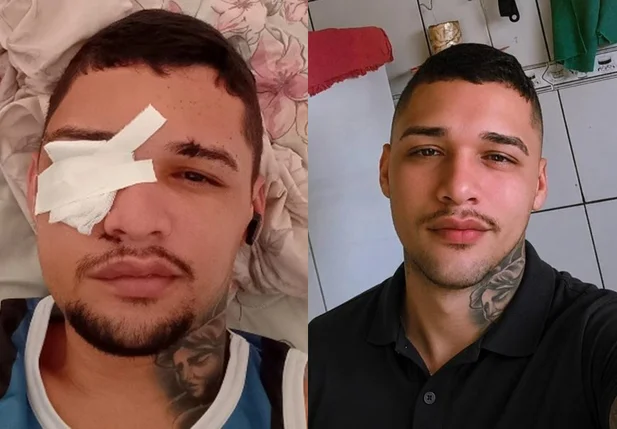 João Marcelo Guimarães, 25 anos