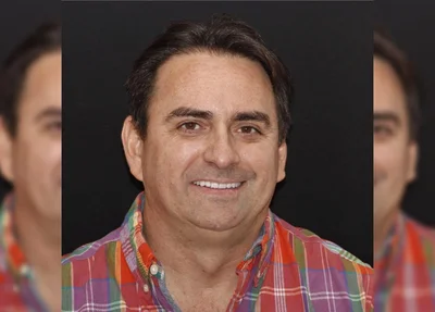 Raimundo Neto e Silva Nogueira Lima