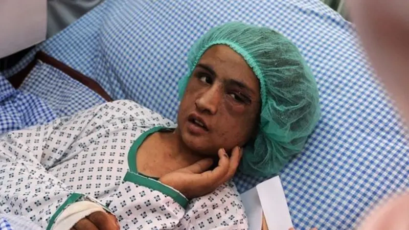 Sahar Gul, de 15 anos, foi resgatada; a família de seu marido bateu nela e a prendeu durante 5 meses em um banheiro após ela se negar a se prostituir (2016)