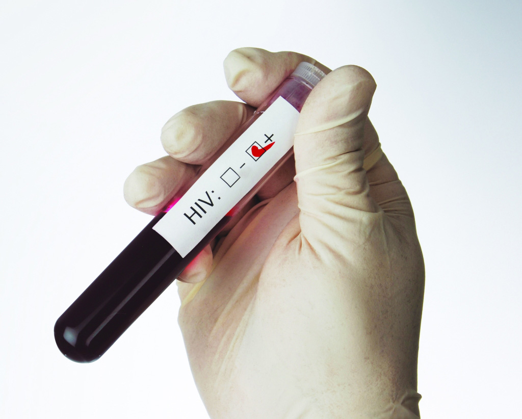 Fortaleza concentra 55% dos casos de aids do Ceará em 2016