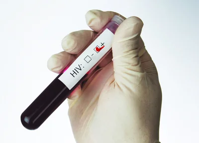 Fortaleza concentra 55% dos casos de aids do Ceará em 2016
