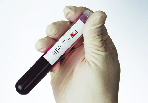 Fortaleza concentra 55% dos casos de aids do Ceará em 2016