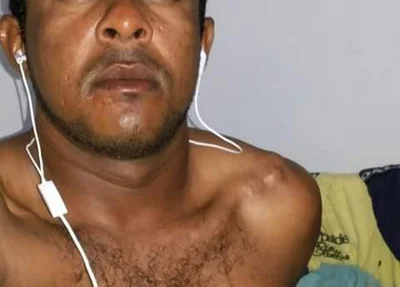 Acusado de matar o vereador Tote Aristides 
