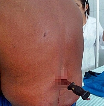 Homem ferido em Piracuruca