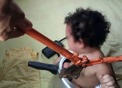 Bebê presa em panela de pressão