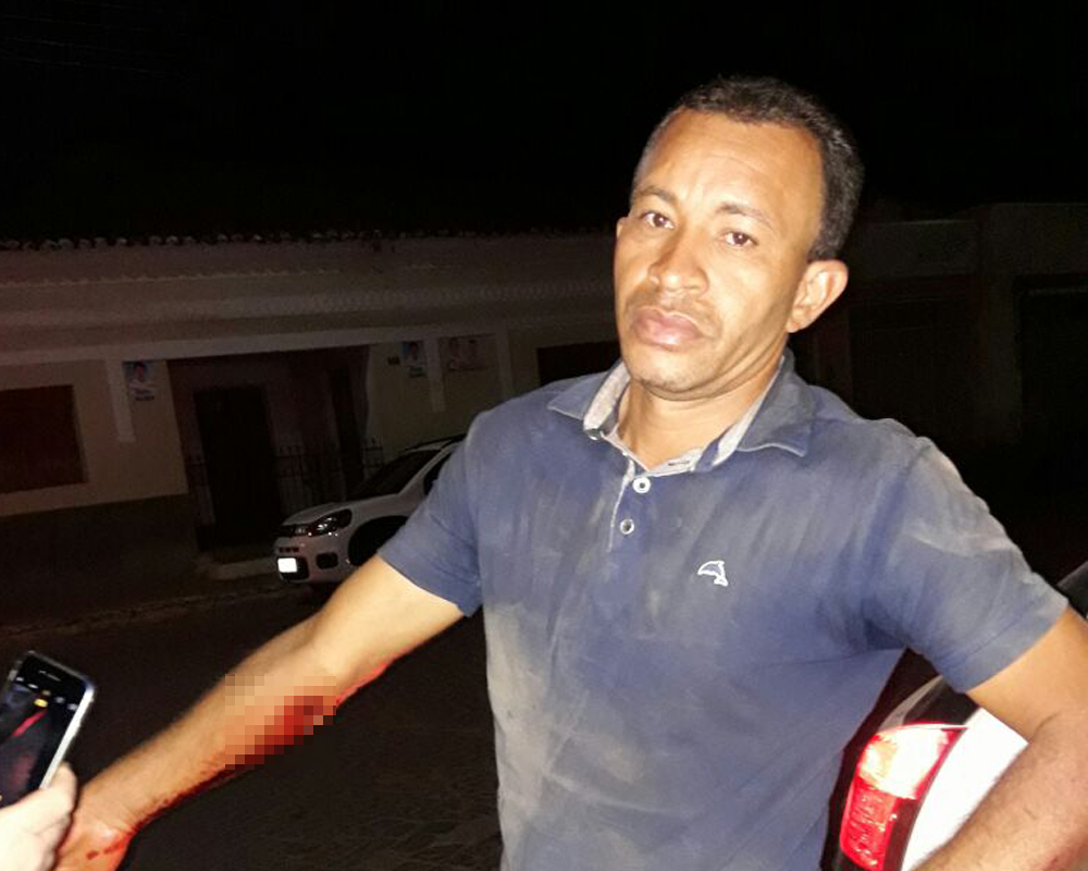 Adailton após ser alvejado no braço
