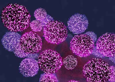 Uma em cada dez crianças com HIV é imune à Aids, diz estudo