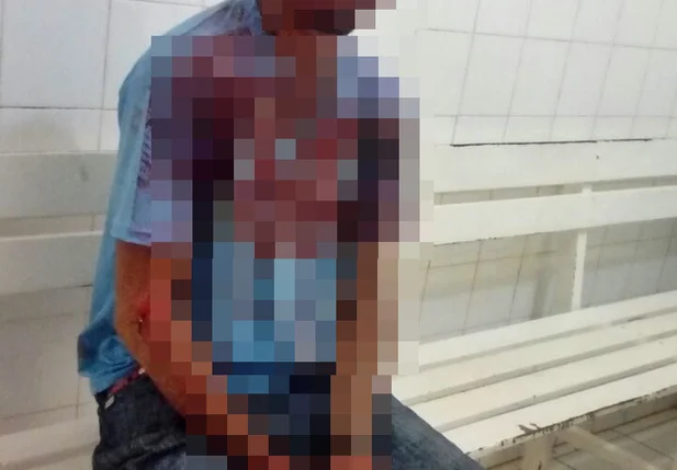 Motoqueiro fica ferido enquanto tentava capturar pokemóns no Piauí