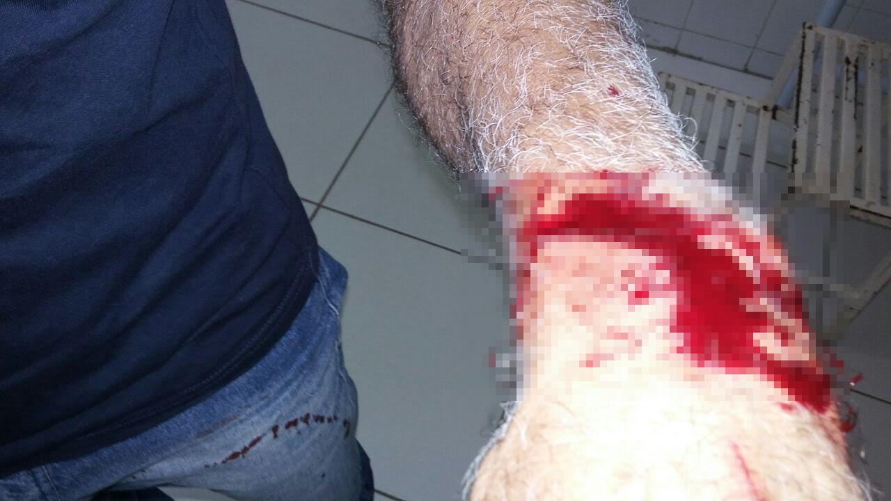 Pereira foi agredido com golpes de facão