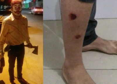 Jovem foi baleado na perna