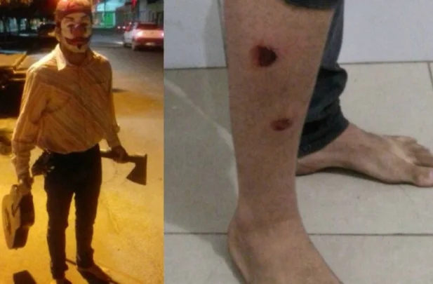 Jovem foi baleado na perna