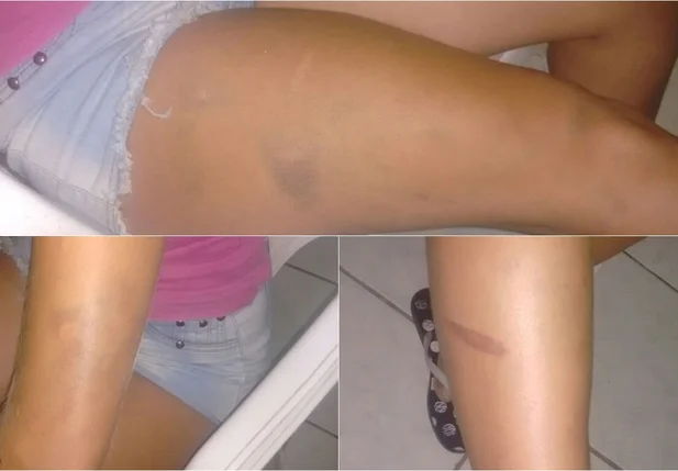 A jovem foi encontrada lesionada