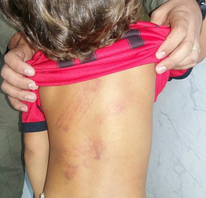 Mãe é detida acusada de agredir o filho de três anos usando um cinto