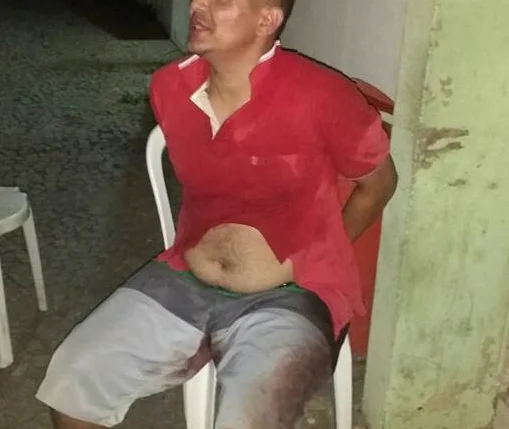 Homem tenta roubar arma de vigilante e é alvejado