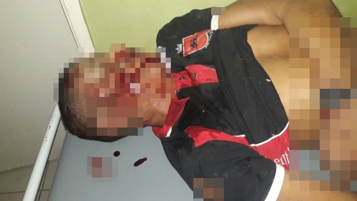 Homem após sofrer acidente em São João do Arrail