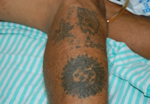 Tatuagens podem ajudar na identificação