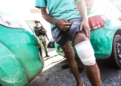 Idoso é agredido durante tentativa de assalto