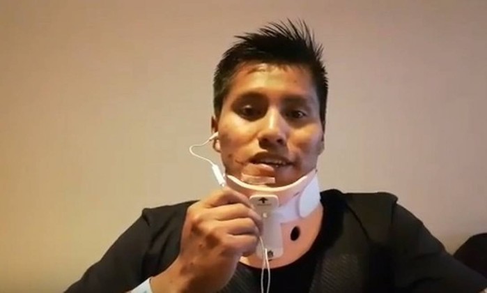 Erwin Tumiri 