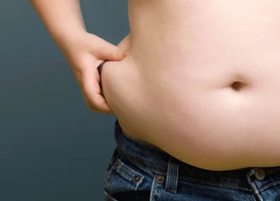 Obesidade