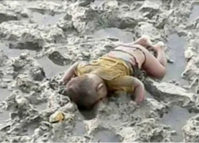 Bebê Mohammed Shohaynet, de 6 meses