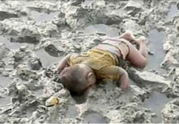 Bebê Mohammed Shohaynet, de 6 meses