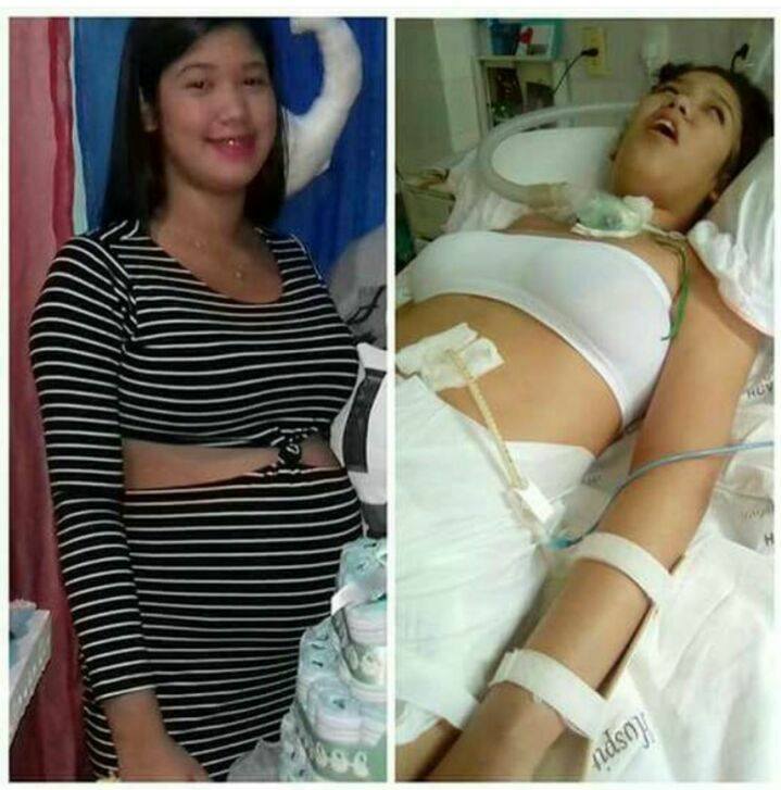 Karem Rafaela antes e depois da cirurgia