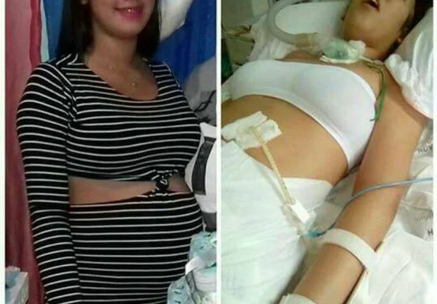 Karem Rafaela antes e depois da cirurgia