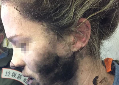 Fones de ouvido de passageira pegam fogo em voo