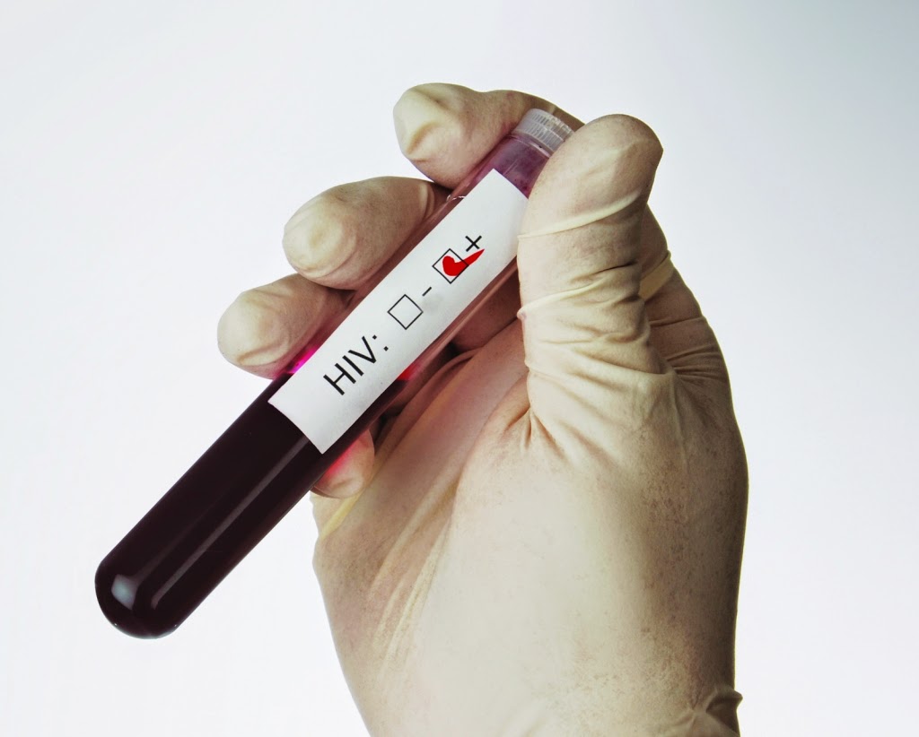 Vírus HIV