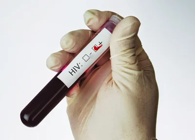 Vírus HIV