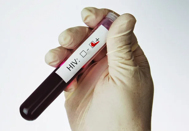 Vírus HIV