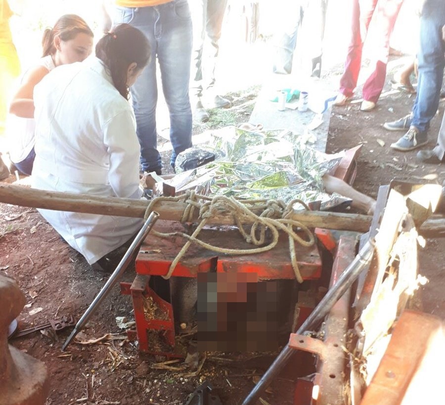 Homem teve perna amputada após acidente de trabalho