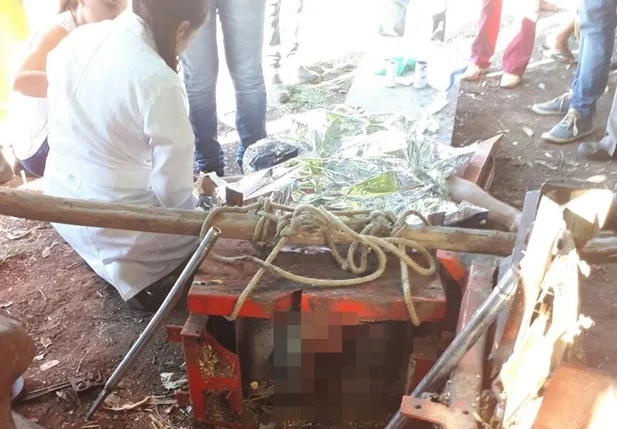 Homem teve perna amputada após acidente de trabalho