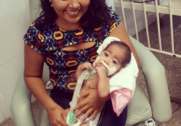 Família pede ajuda para bebê com síndrome rara