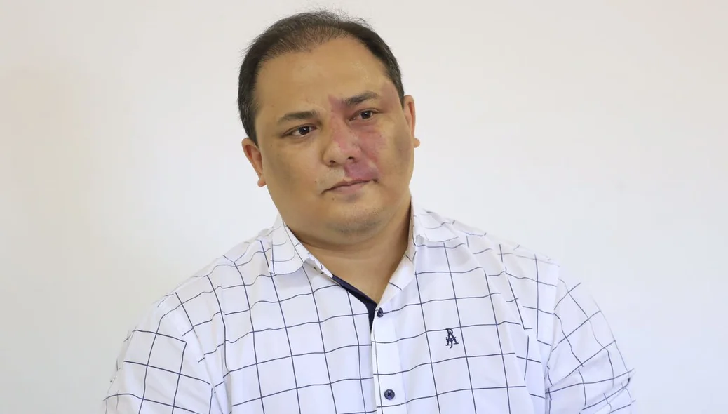 Delegado Luccy Keiko
