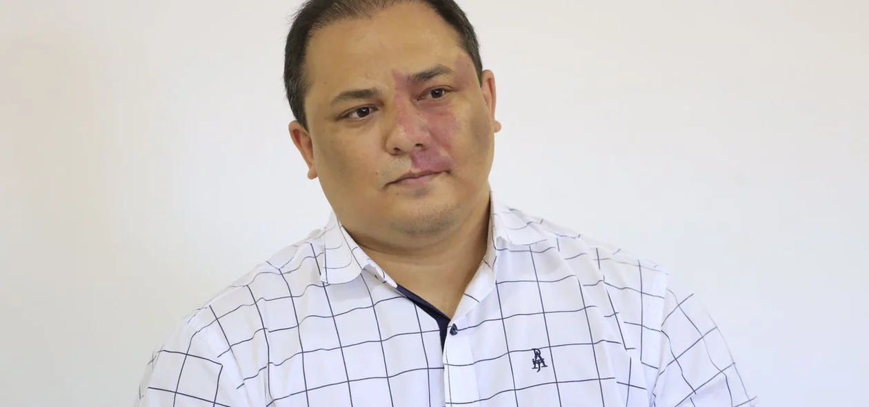 Delegado Luccy Keiko