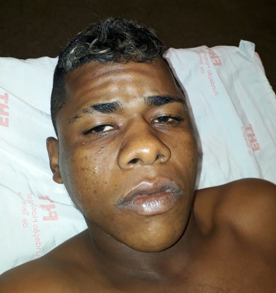 Homem foi atingido por arma de fogo durante festa junina