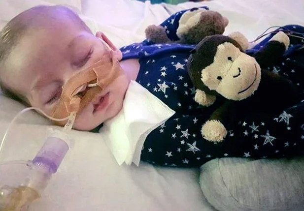 A síndrome rara de Charlie Gard impede que ele se mova